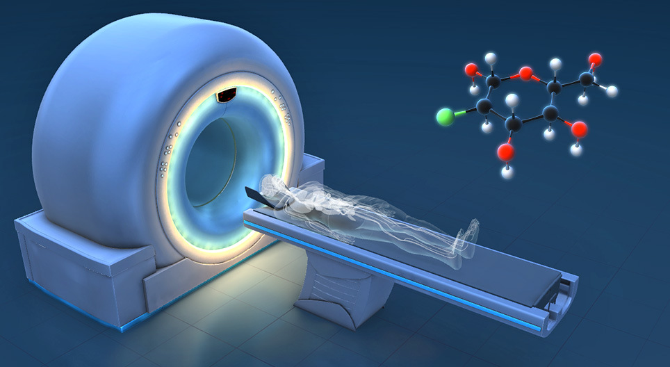 Jak funguje PET-CT?