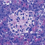 췌장의 세포 무리인데 인슐린을 생성해요