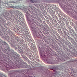 Tendon (cross section)