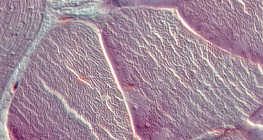 Tendon (cross section)