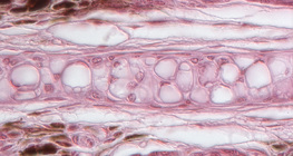 cartilaginous tissue