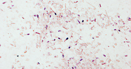 Tetanus bacteria