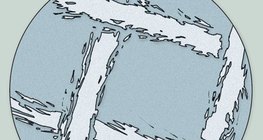 Microscopic image of gauze