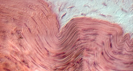 Smooth muscle tissue&nbsp;(in the stomach wall)