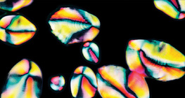 Starch granules in potato