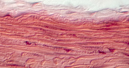 Smooth muscle tissue&nbsp;(in the stomach wall)