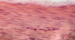 Smooth muscle tissue&nbsp;(in the stomach wall)