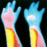 Стеснение в артерия, причинено от тютюнопушене