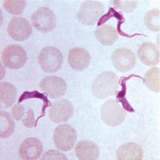 Спираловидната бактерия на сифилиса