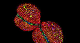Mirabilis flower pollen sac (confocal laser scanning microscope)