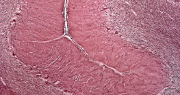 Section of human cerebellum