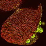 Mirabilis pollen sack, opened (confocal laser scanning microscope)