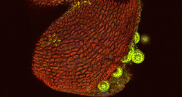 Mirabilis pollen sack, opened (confocal laser scanning microscope)