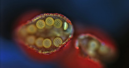 Mirabilis pollen sack, opened (optical microscope)