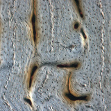Bone (longitudinal section)