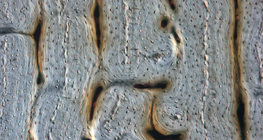 Bone (longitudinal section)