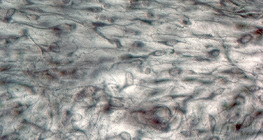 Loose connective tissue