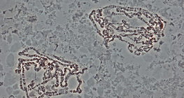 Giant&nbsp;Drosophila chromosomes (taken from the salivary gland)