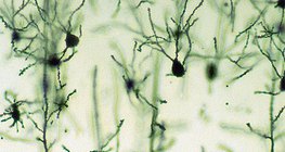 Neurons of the cerebral cortex