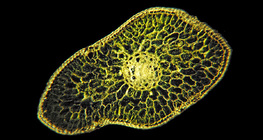 Cross section of silver fir leaf