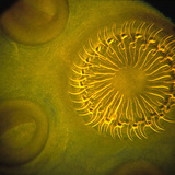 Tapeworm scolex (head) with&nbsp;hooks and suckers