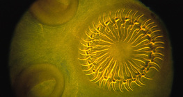 Tapeworm scolex (head) with&nbsp;hooks and suckers