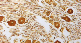 Nerve cells in the spinal ganglion