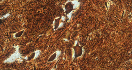 Nerve cells in the spinal cord (cattle)