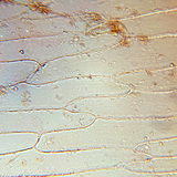 Cells of the fleshy scale leaves of an onion