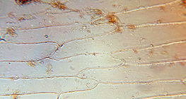 Cells of the fleshy scale leaves of an onion