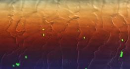 Fluorescent E.coli bacteria on hair