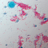 TB pathogen, Mycobacterium tuberculosis