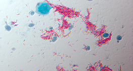 TB pathogen, Mycobacterium tuberculosis