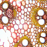Vascular bundles, cross section (monocot)