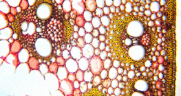 Vascular bundles, cross section (monocot)