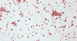 Gonorrhoea pathogen, Neisseria gonorrhoeae