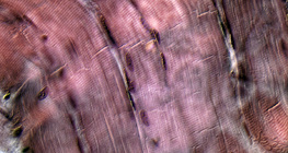 Striated muscle tissue
