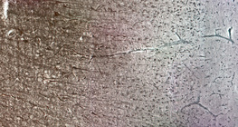 Human cerebral cortex with the different cell layers