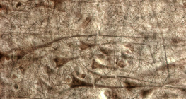 Human cerebral cortex with giant pyramidal cells