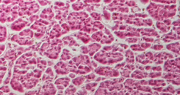 Section of pancreas