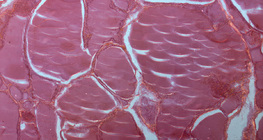 Section of thyroid gland