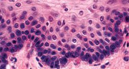 Non-keratinised stratified squamous