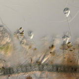 Water from a fish tank with vorticella, stentor and algae