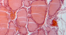 Section of thyroid gland