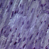 Cardiac muscle tissue