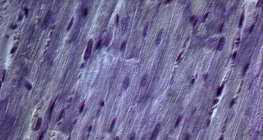 Cardiac muscle tissue