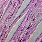 Cardiac muscle tissue