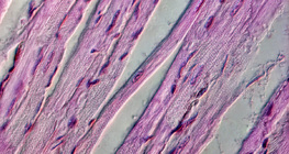 Cardiac muscle tissue