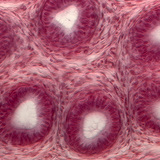 Section of seminiferous tubules