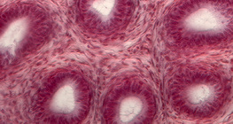 Section of seminiferous tubules